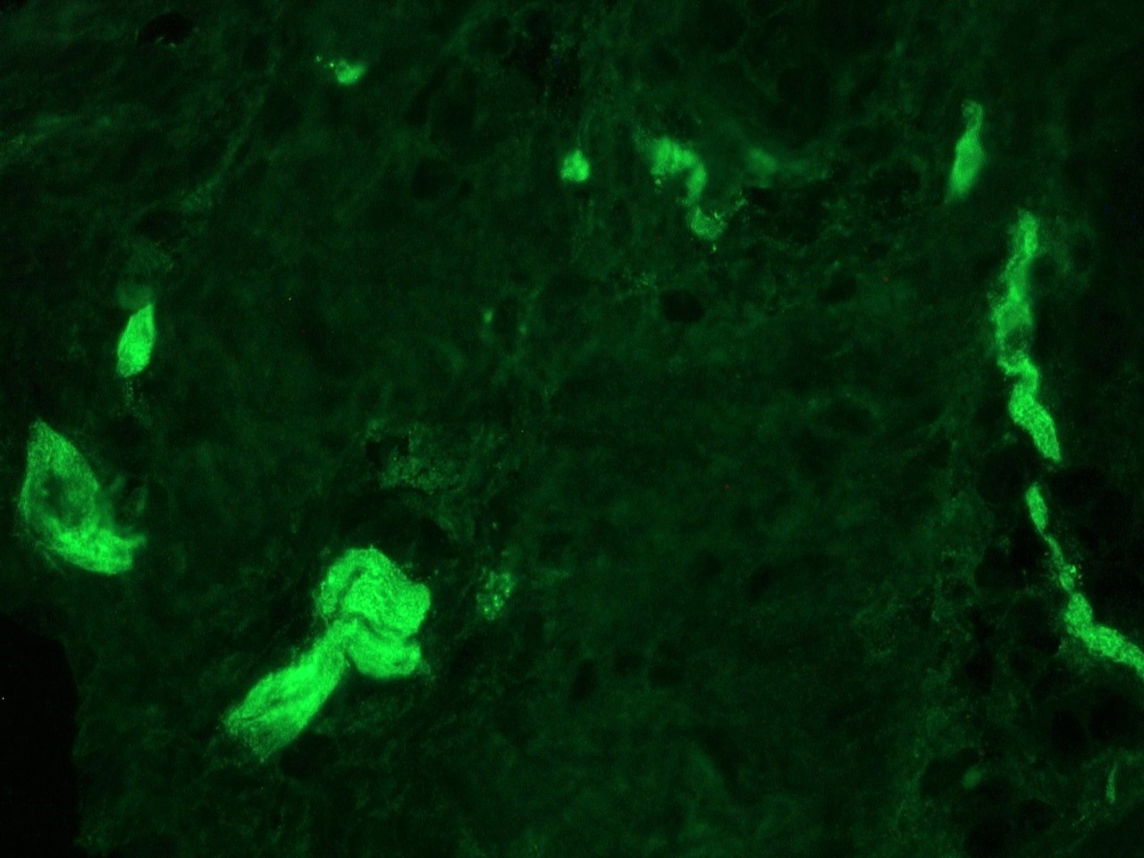 Figure 4. Indirect immunofluorescence staining of swine colon frozen tissue sections with 0566P (diluted 1:500), showing the specific pattern of NCAM/CD56 in the nerves innervating the tissue (parasympathetic ganglion cells in both Auerbach's and Meissner's plexuses). As expected, no reactivity is seen in the epithelial cell compartment, muscle or connective tissue.